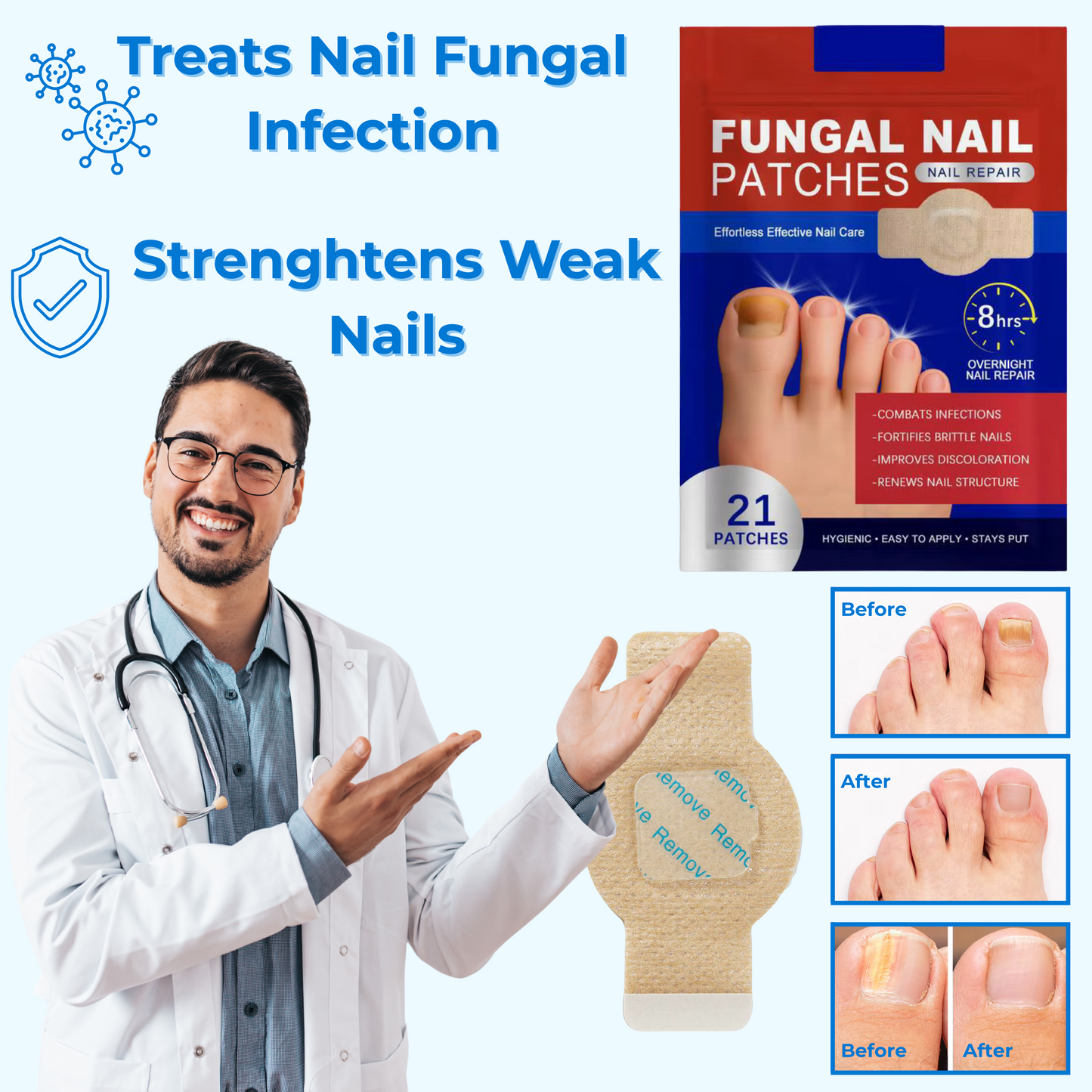 NailEase™ Fungal Nail Repair Patches – 21PCS